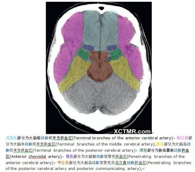 颅脑CT彩色解剖