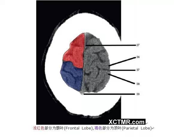 颅脑CT彩色解剖