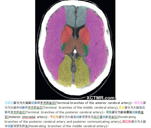颅脑CT彩色解剖