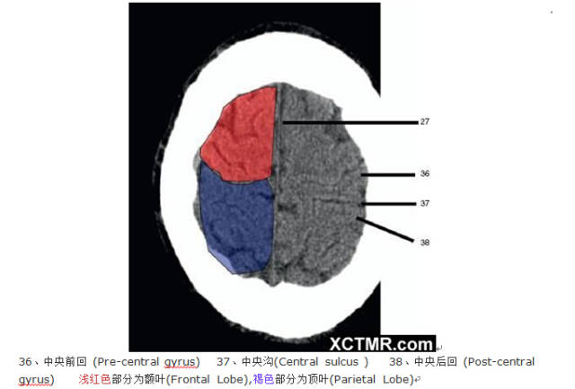颅脑CT彩色解剖