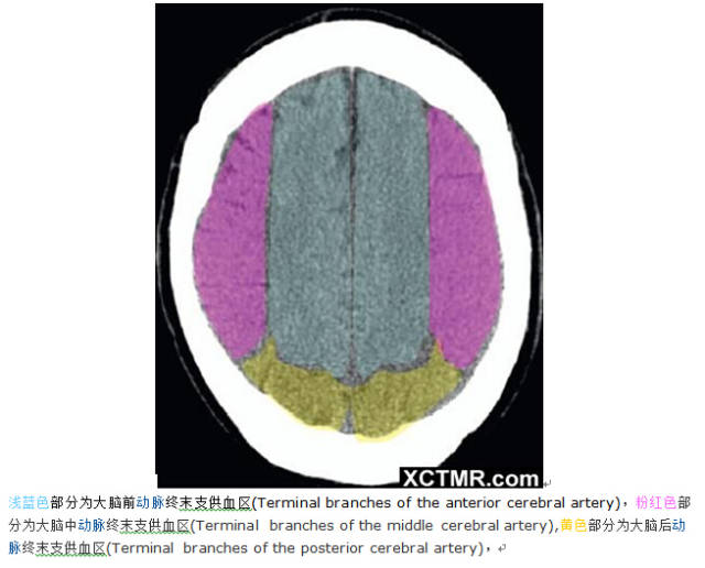 颅脑CT彩色解剖