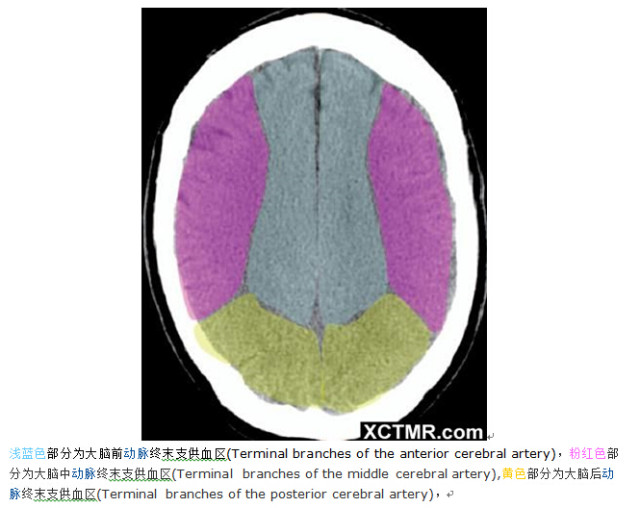 颅脑CT彩色解剖