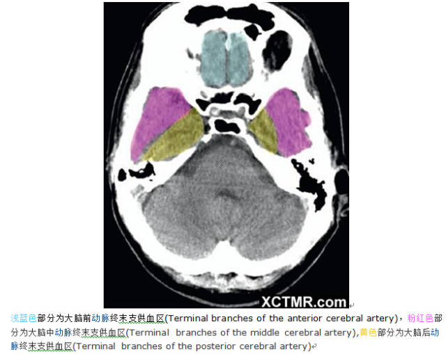 颅脑CT彩色解剖