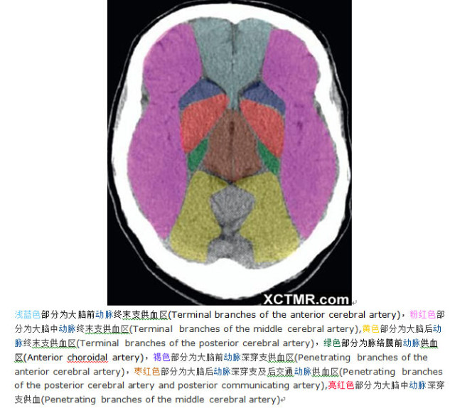 颅脑CT彩色解剖