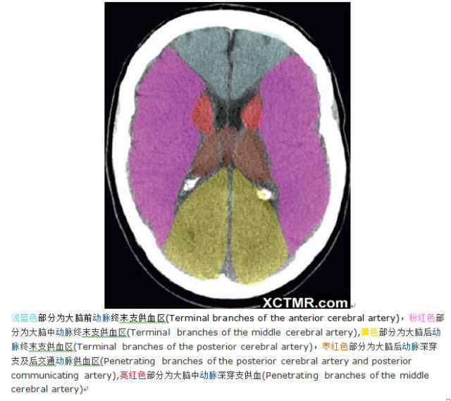 颅脑CT彩色解剖