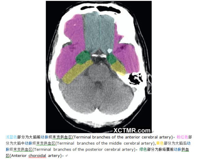 颅脑CT彩色解剖