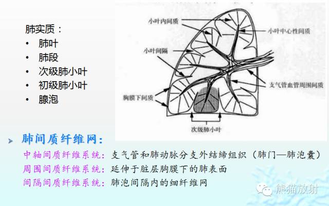 肺粟粒样结节鉴别诊断