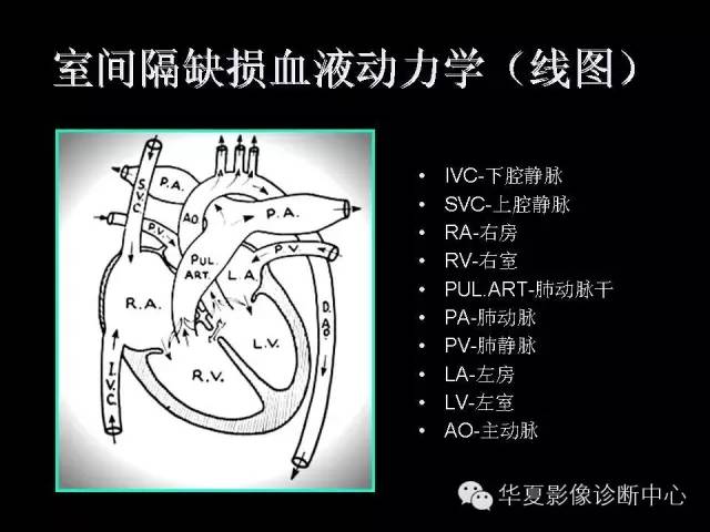 【PPT】先天性心脏病的影像学改变