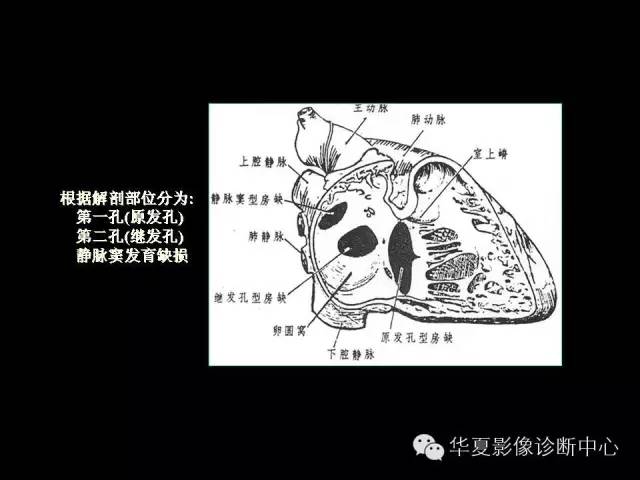 【PPT】先天性心脏病的影像学改变