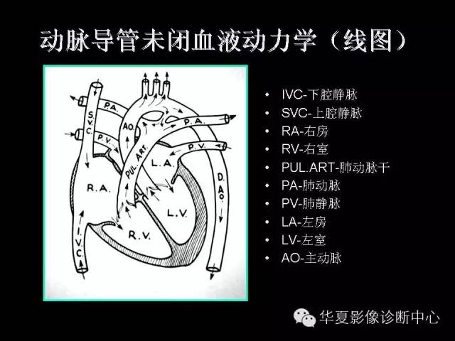【PPT】先天性心脏病的影像学改变