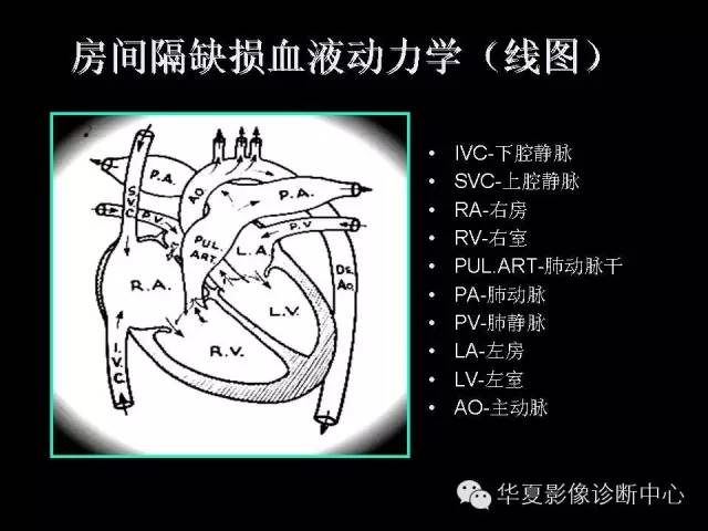 【PPT】先天性心脏病的影像学改变