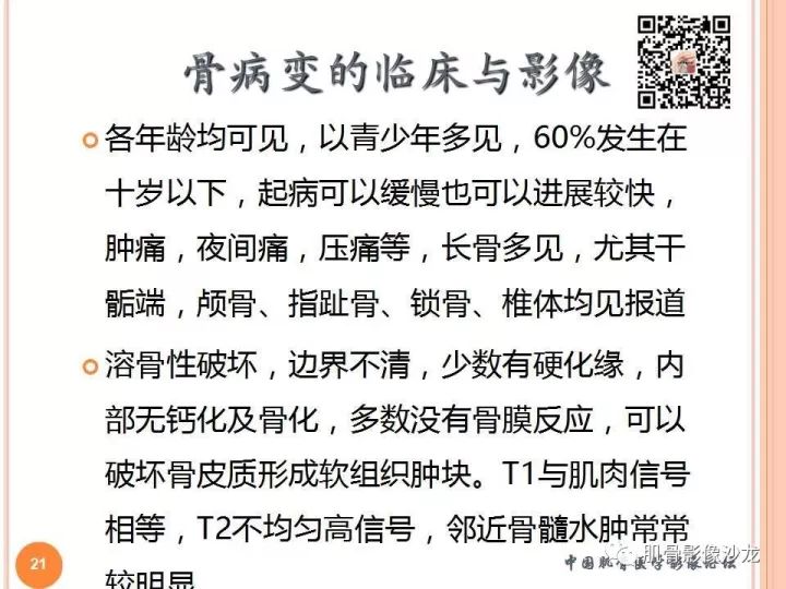 【PPT】骨与软组织Rosai-Dorfman病