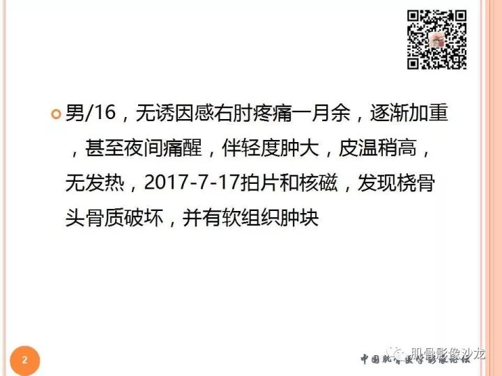 【PPT】骨与软组织Rosai-Dorfman病