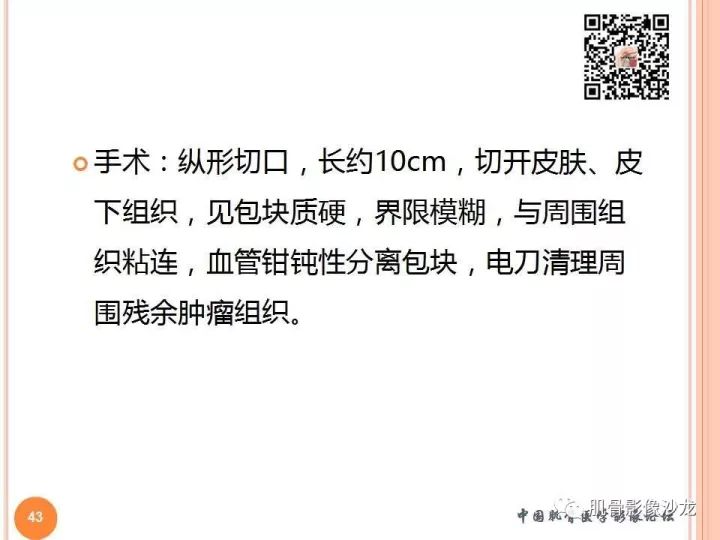 【PPT】骨与软组织Rosai-Dorfman病