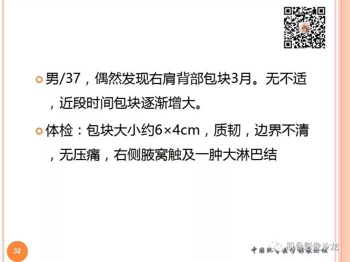 【PPT】骨与软组织Rosai-Dorfman病