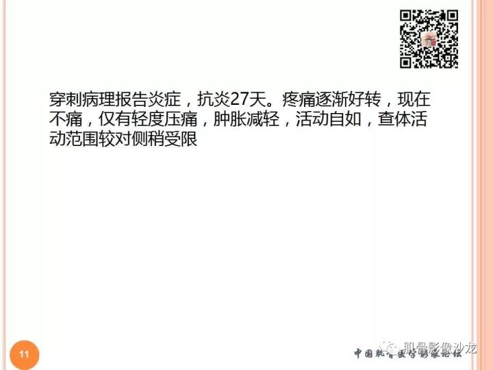 【PPT】骨与软组织Rosai-Dorfman病