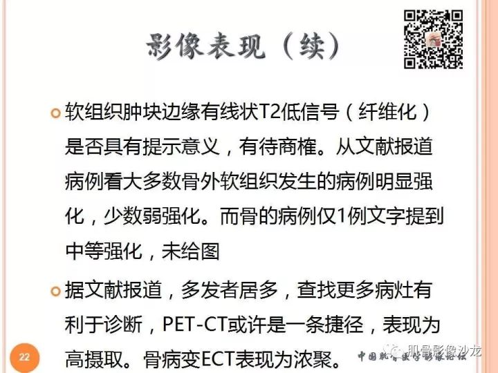 【PPT】骨与软组织Rosai-Dorfman病