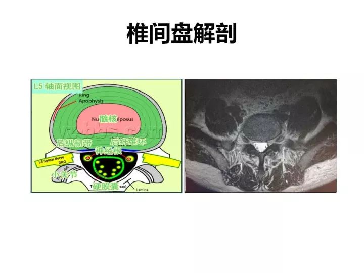 【PPT】腰椎退行性疾病影像学诊断