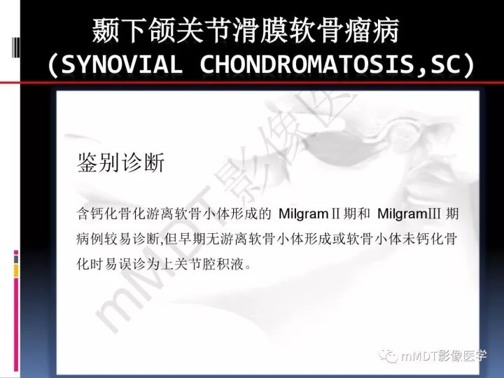 【PPT】颞下颌关节滑膜骨软骨瘤病MR分期诊断