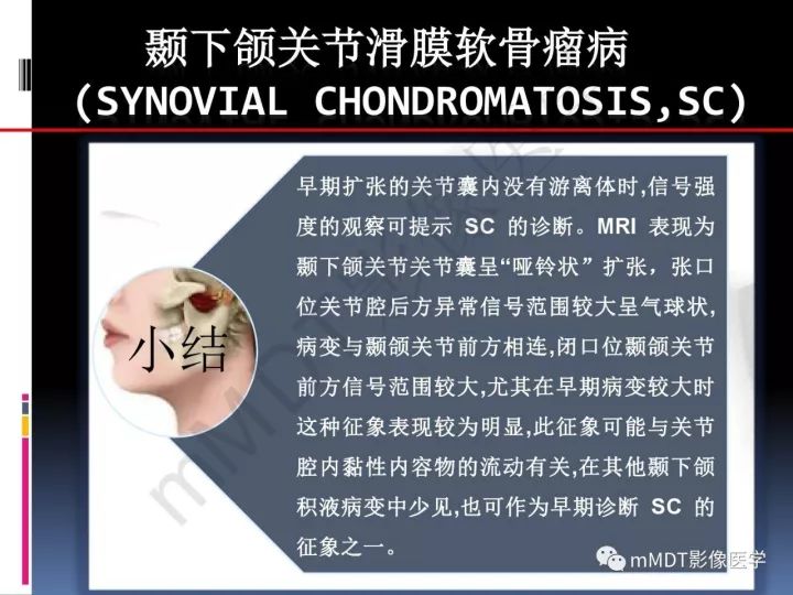 【PPT】颞下颌关节滑膜骨软骨瘤病MR分期诊断