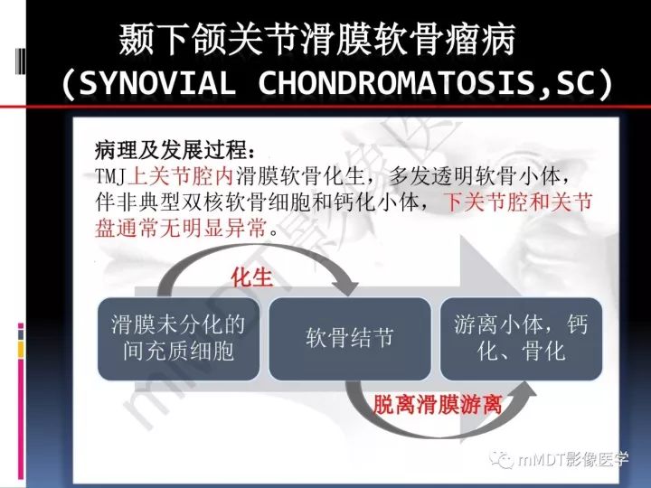 【PPT】颞下颌关节滑膜骨软骨瘤病MR分期诊断