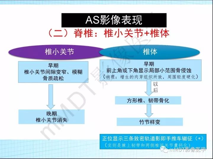 【PPT】骶髂关节非肿瘤病变的影像诊断