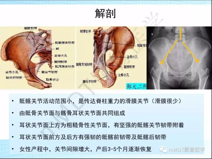 【PPT】骶髂关节非肿瘤病变的影像诊断