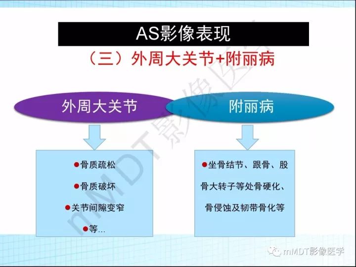 【PPT】骶髂关节非肿瘤病变的影像诊断