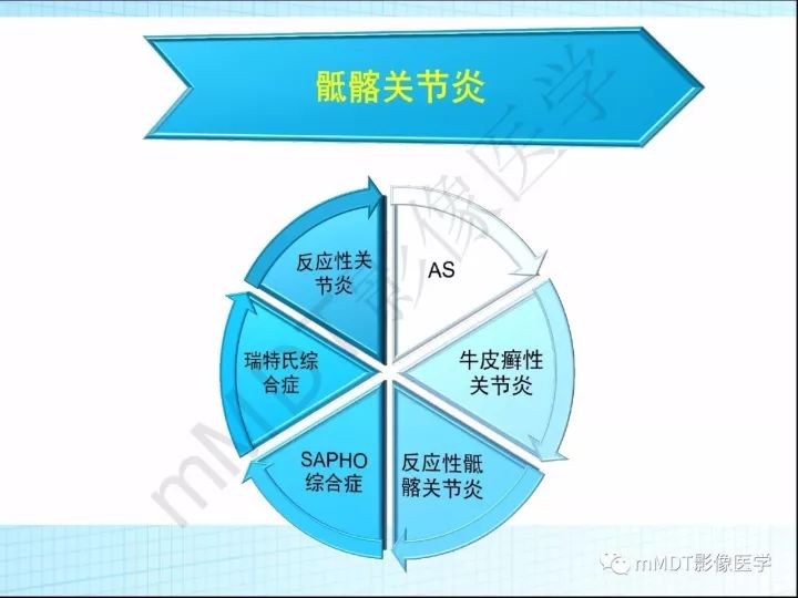 【PPT】骶髂关节非肿瘤病变的影像诊断