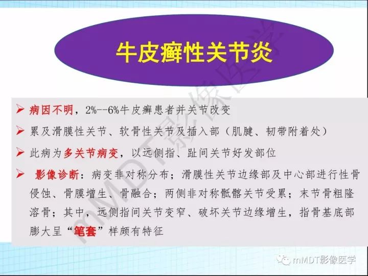 【PPT】骶髂关节非肿瘤病变的影像诊断