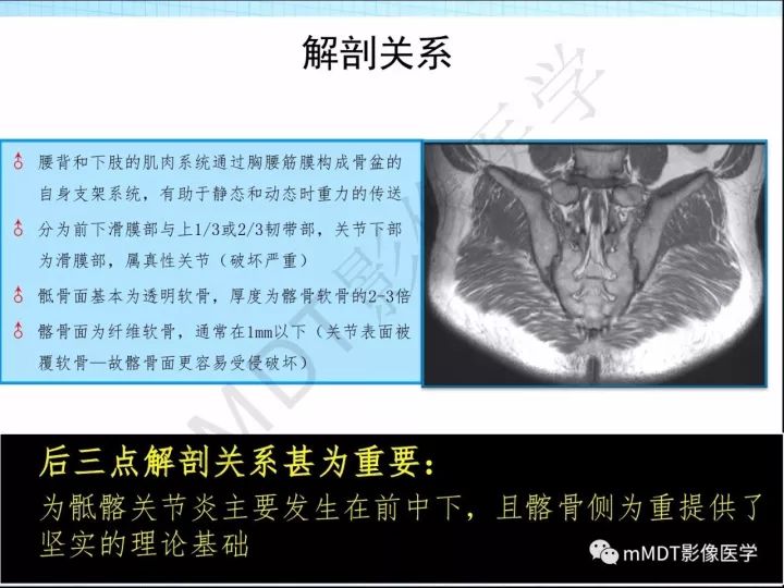 【PPT】骶髂关节非肿瘤病变的影像诊断