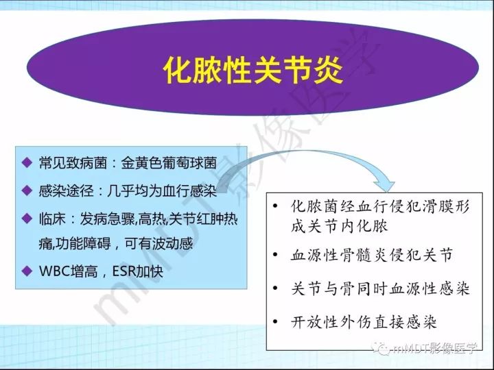 【PPT】骶髂关节非肿瘤病变的影像诊断