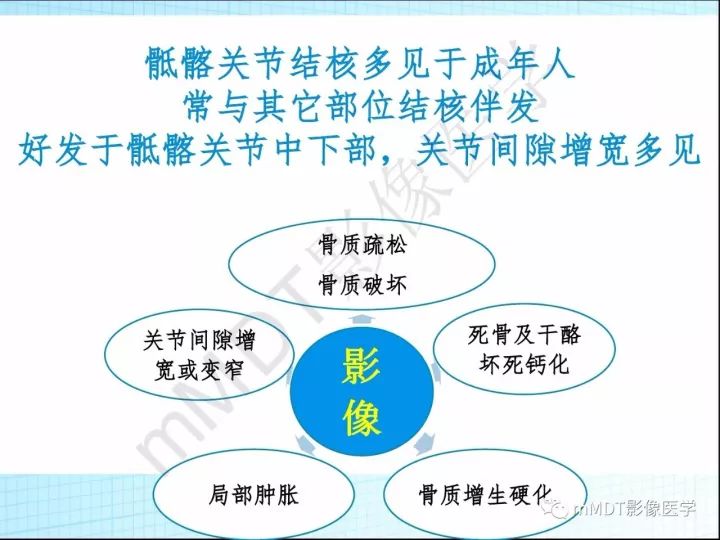 【PPT】骶髂关节非肿瘤病变的影像诊断