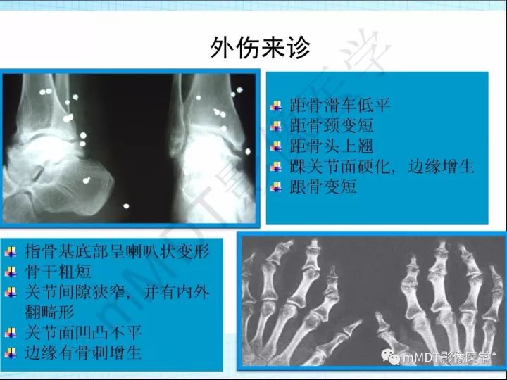 【PPT】骶髂关节非肿瘤病变的影像诊断