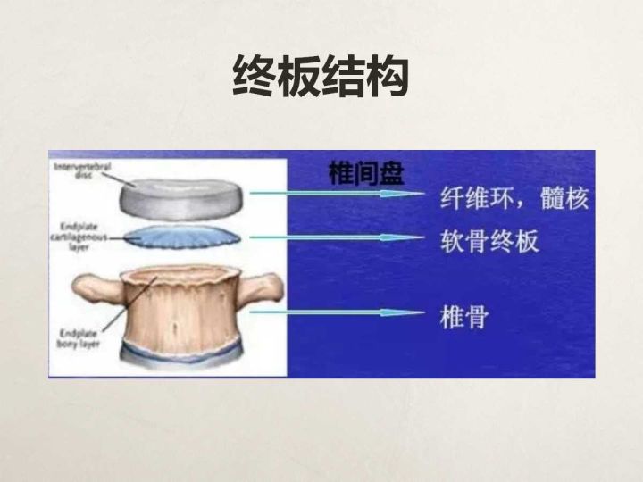 【PPT】终板退变