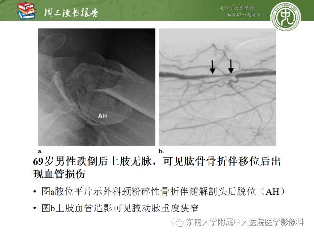 【PPT】急性肩关节损伤：外科医生想获知的内容