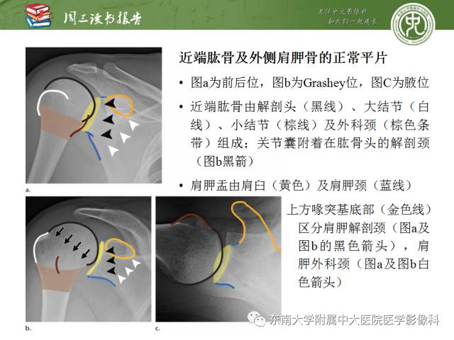 【PPT】急性肩关节损伤：外科医生想获知的内容