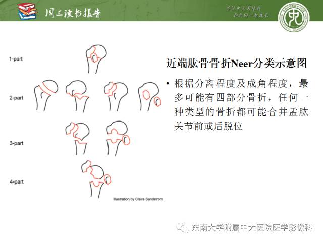 【PPT】急性肩关节损伤：外科医生想获知的内容