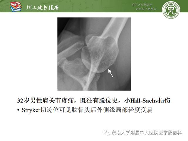 【PPT】急性肩关节损伤：外科医生想获知的内容