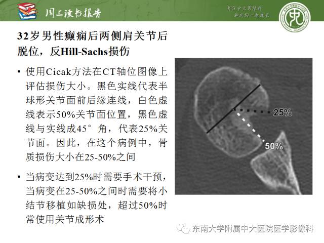 【PPT】急性肩关节损伤：外科医生想获知的内容