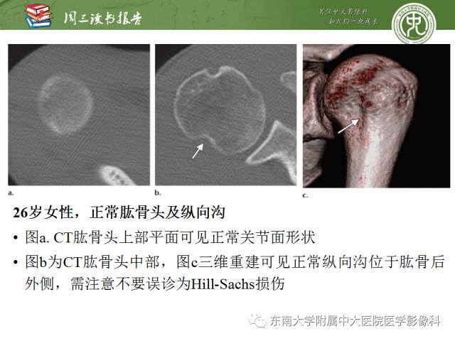 【PPT】急性肩关节损伤：外科医生想获知的内容