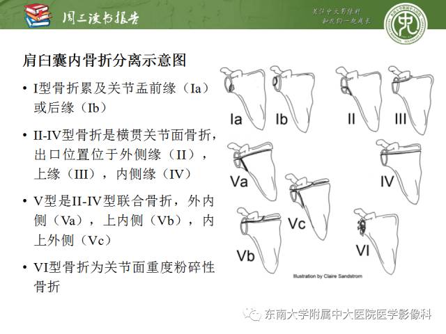 【PPT】急性肩关节损伤：外科医生想获知的内容