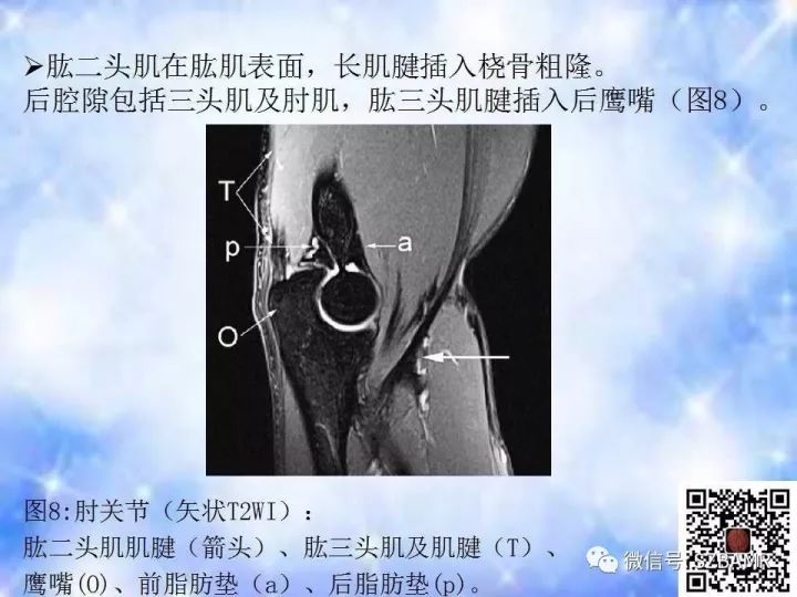 【PPT】肘关节磁共振正常解剖及假性病变