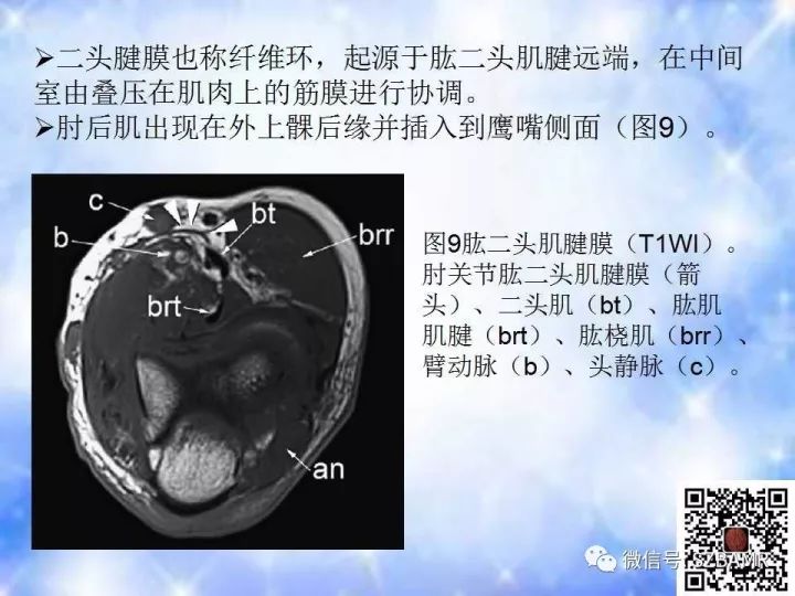 【PPT】肘关节磁共振正常解剖及假性病变