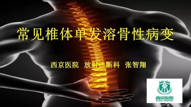 【PPT】常见椎体单发溶骨性病变