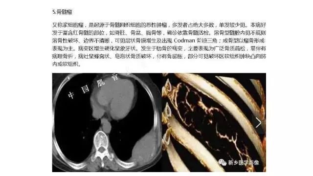 【PPT】常见骨骼病变的诊断与鉴别诊断