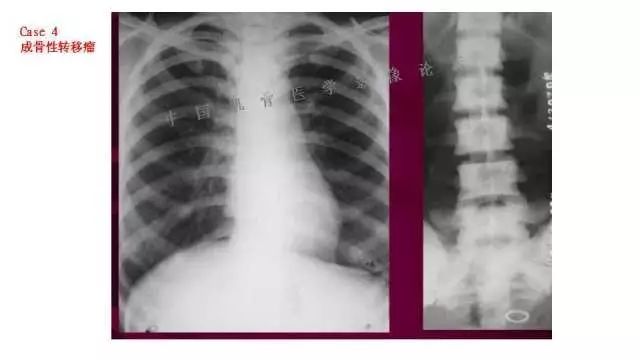 【PPT】常见骨骼病变的诊断与鉴别诊断