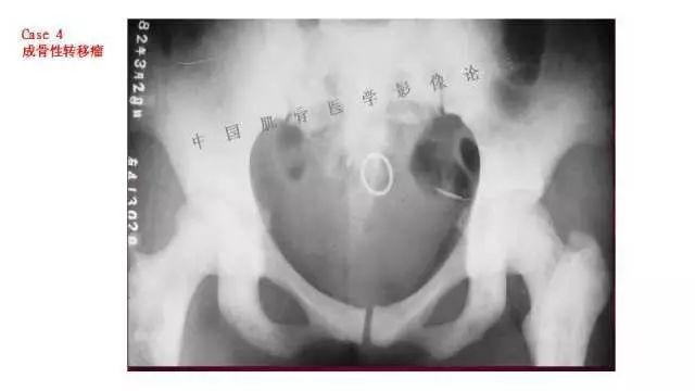 【PPT】常见骨骼病变的诊断与鉴别诊断