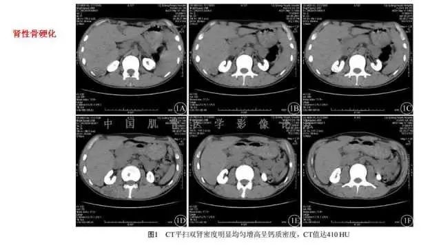 【PPT】常见骨骼病变的诊断与鉴别诊断