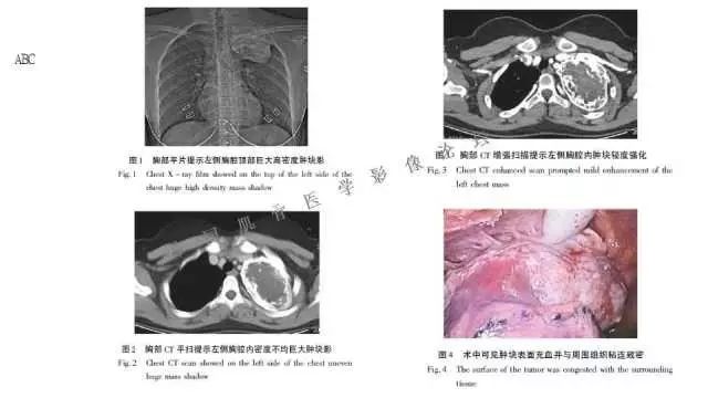 【PPT】常见骨骼病变的诊断与鉴别诊断